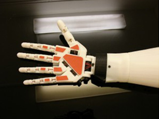 Alex Hand und Unterarm mit Handgelenk